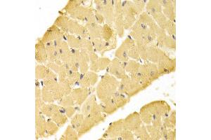 Immunohistochemistry (IHC) image for anti-14-3-3 alpha + beta (YWHAB) (AA 1-246) antibody (ABIN3021285)