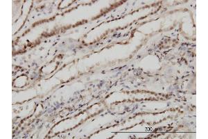 Immunoperoxidase of monoclonal antibody to TSG101 on formalin-fixed paraffin-embedded human kidney.