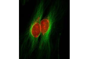 Immunocytochemistry (ICC) image for anti-Small Ubiquitin Related Modifier Protein 1 (SUMO1) (AA 2-20) antibody (ABIN1742528)