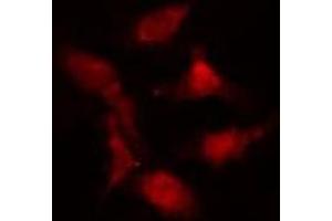 ABIN6274986 staining  Hela cells by IF/ICC. (CEP290 anticorps  (Internal Region))