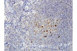 Immunoperoxidase of monoclonal antibody to ADAMDEC1 on formalin-fixed paraffin-embedded human tonsil.