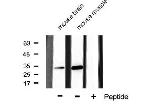 Western blot analysis of CDK5 phosphorylation expression in mouse brain and mouse muscle cell lysates,The lane on the right is treated with the antigen-specific peptide. (CDK5 anticorps  (pTyr15))