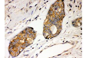 Anti- IKB alpha Picoband antibody, IHC(P) IHC(P): Human Mammary Cancer Tissue