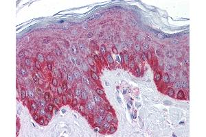 anti-Coiled-Coil Domain Containing 151 (CCDC151) (C-Term) antibody