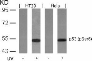 Image no. 2 for anti-Tumor Protein P53 (TP53) (pSer6) antibody (ABIN319211) (p53 anticorps  (pSer6))