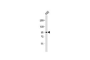 Anti-B-RAF Antibody  at 1:2000 dilution + A20 whole cell lysate Lysates/proteins at 20 μg per lane.
