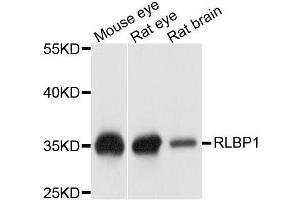 Western blot analysis of extracts of various cell lines, using RLBP1 antibody. (RLBP1 anticorps  (AA 1-317))