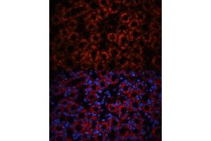 Immunofluorescence analysis of mouse kidney using Lipocalin-2/NGAL antibody (ABIN3017525, ABIN3017526, ABIN3017527 and ABIN6220135) at dilution of 1:100.