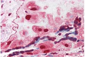 Human Placenta (formalin-fixed, paraffin-embedded) stained with ORAI3 antibody ABIN351441 at 3 ug/ml followed by biotinylated goat anti-rabbit IgG secondary antibody ABIN481713, alkaline phosphatase-streptavidin and chromogen. (ORAI3 anticorps  (C-Term))