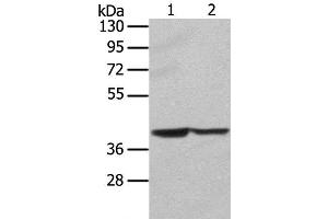 Western Blot analysis of Hela and hepg2 cell using STX16 Polyclonal Antibody at dilution of 1:400 (Syntaxin 16 anticorps)