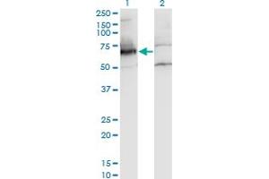 Western Blot analysis of NXF2 expression in transfected 293T cell line by NXF2 monoclonal antibody (M01A), clone 4F5-3A2. (NXF2 anticorps  (AA 1-626))