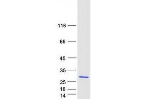Validation with Western Blot