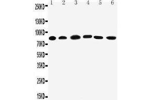 Anti-PC1/3 antibody, Western blotting Lane 1: Rat Liver Tissue Lysate Lane 2: Rat Thymus Tissue Lysate Lane 3: A549 Cell Lysate Lane 4: HELA Cell Lysate Lane 5: COLO320 Cell Lysate Lane 6: PANC Cell Lysate