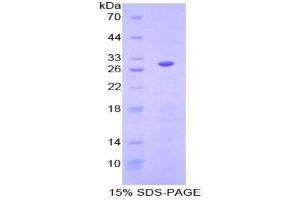 SDS-PAGE of Protein Standard from the Kit (Highly purified E. (Granulin Kit CLIA)
