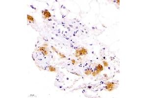 Immunohistochemistry of paraffin embedded rat lung using Calcitonin (ABIN7073271) at dilution of 1:700 (400x lens)