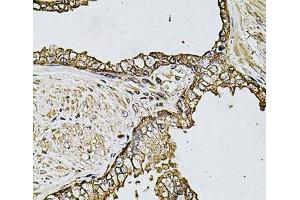 Immunohistochemistry of paraffin-embedded Human prostate using CSTB Polyclonal Antibody at dilution of 1:100 (40x lens).