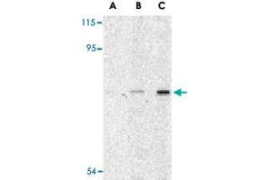 Western blot analysis of ATG7 in L1210 cell lysate with ATG7 polyclonal antibody  at (A) 1, (B) 2 and (C) 4 ug/mL .