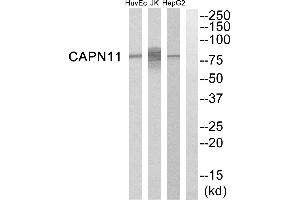 Western blot analysis of extracts from HepG2 cells, Jurkat cells and HuvEc cells, using CAPN11 antibody. (CAPN11 anticorps)
