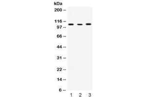 Western blot testing of 1) rat liver, 2) mouse Neuro-2A and 3) human Raji lysate with ACTN4 antibody at 0. (alpha Actinin 4 anticorps)