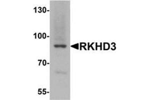 Western blot analysis of RKHD3 in mouse skeletal muscle tissue lysate with RKHD3 antibody at 1 ug/mL. (MEX3B anticorps  (Middle Region))