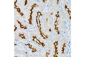 Immunofluorescence analysis of rat testis using  Rabbit pAb (ABIN6131167, ABIN6136429, ABIN6136430 and ABIN6216480) at dilution of 1:100 (40x lens).