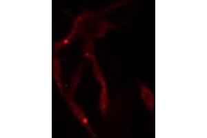 ABIN6275040 staining  NIH-3T3 cells by IF/ICC. (Superoxide dismutase copper chaperone anticorps  (C-Term))