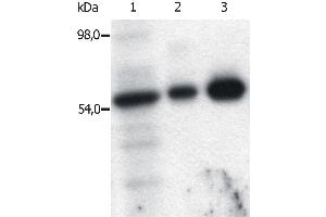 Immunoprecipitation of Fyn from the lysate of T cells isolated from fresh buffy coats.