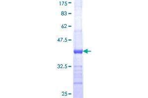 Image no. 1 for UDP-Gal:betaGal beta 1,3-Galactosyltransferase Polypeptide 6 (B3GALT6) (AA 229-329) protein (GST tag) (ABIN1346282)