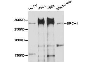 Western blot analysis of extracts of various cell lines, using BRCA1 antibody. (BRCA1 anticorps  (AA 400-699))