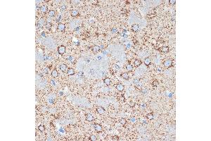 Immunohistochemistry of paraffin-embedded rat brain using GOT2 Rabbit mAb (ABIN7267427) at dilution of 1:100 (40x lens).