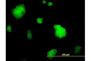 Image no. 4 for anti-Slingshot Homolog 3 (SSH3) (AA 293-392) antibody (ABIN599261) (SSH3 anticorps  (AA 293-392))
