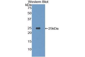 Western blot analysis of the recombinant protein. (TREM1 anticorps  (AA 21-230))