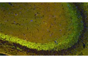 Indirect immunolabeling of mouse hippocampus section with anti-synapsin 2 (dilution 1 : 200; red) and mouse anti-synapsin 1 (, dilution 1 : 500; green). (SYN2 anticorps)