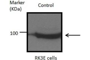 WB Image Sample(30 μg of whole cell lysate) A:293T B:A431, 7.