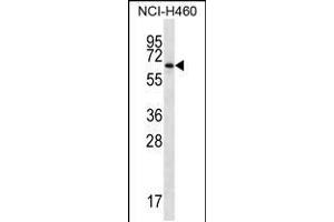 Western blot analysis in NCI-H460 cell line lysates (35ug/lane). (ZBTB46 anticorps  (AA 251-279))