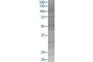 IRF3 transfected lysate. (IRF3 293T Cell Transient Overexpression Lysate(Denatured))