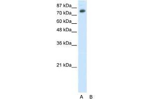 WB Suggested Anti-TSC22D2 Antibody Titration:  0. (TSC22D2 anticorps  (N-Term))
