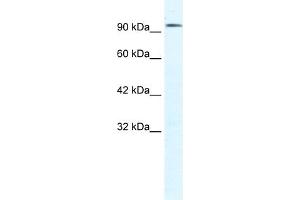 WB Suggested Anti-CLCN3 Antibody Titration:  1. (CLCN3 anticorps  (C-Term))