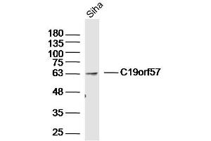 Siha lysates probed with C19orf57 Polyclonal Antibody, Unconjugated  at 1:300 dilution and 4˚C overnight incubation. (C19ORF57 anticorps  (AA 1-100))