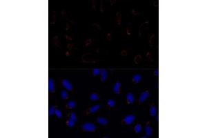 Immunofluorescence analysis of U2OS cells using TR antibody (ABIN1683134, ABIN5664756, ABIN5664758 and ABIN6220605) at dilution of 1:100.