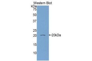 Western Blotting (WB) image for anti-Retinol Binding Protein 5, Cellular (RBP5) (AA 2-135) antibody (ABIN1860418) (Retinol Binding Protein 5 anticorps  (AA 2-135))