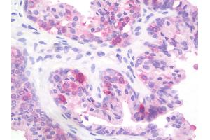 Anti-PTPRD / RPTP-Delta antibody IHC staining of human prostate.