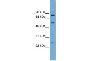 WB Suggested Anti-TFEB Antibody Titration: 0. (TFEB anticorps  (Middle Region))