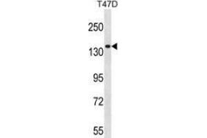 Western blot analysis in T47D cell line lysates (35ug/lane) using Myosin-Ie Antibody (N-term). (MYO1E anticorps  (N-Term))