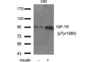 Western blot analysis of extract from 293 cells using IGF-1R (Phospho-Tyr1280). (IGF1R anticorps  (pTyr1280))