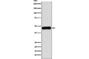 Western blot analysis of DNAJA1 expression in Jurkat cell lysate.