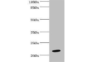 Western blot All lanes: NME6 antibody at 2 μg/mL + Hela whole cell lysate Secondary Goat polyclonal to rabbit IgG at 1/10000 dilution Predicted band size: 22, 14, 19 kDa Observed band size: 22 kDa (NME6 anticorps  (AA 1-186))