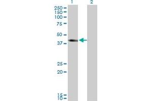 Western Blot analysis of SLC12A1 expression in transfected 293T cell line by SLC12A1 monoclonal antibody (M03), clone 4H4.