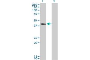 Western Blot analysis of SLC12A1 expression in transfected 293T cell line by SLC12A1 monoclonal antibody (M03), clone 4H4. (SLC12A1 anticorps  (AA 80-172))
