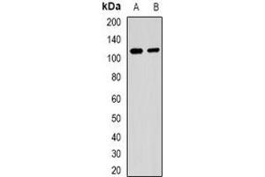 Western blot analysis of MALT1 expression in Raji (A), 293T (B) whole cell lysates.